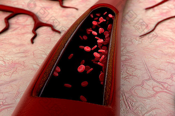 血船只红细胞动脉动脉所示减少部分血凝块船只脂肪细胞血内部血船