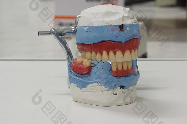 人工假牙制造业步骤牙科实验室