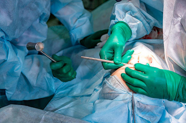 外科医生助理执行化妆品手术鼻子医院操作房间鼻子重塑增加鼻整形术