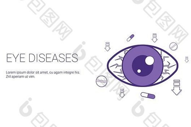 眼睛疾病网络横幅复制空间健康护理概念