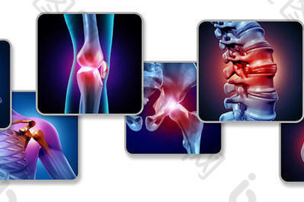 疼痛关节概念骨架肌肉解剖学身体集团痛关节痛苦的受伤关节炎疾病象征