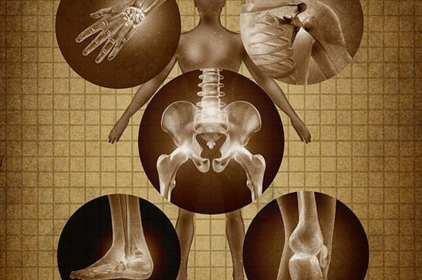 人类痛苦的关节解剖学概念身体疼痛受伤关节炎疾病象征健康护理医疗症状由于老化