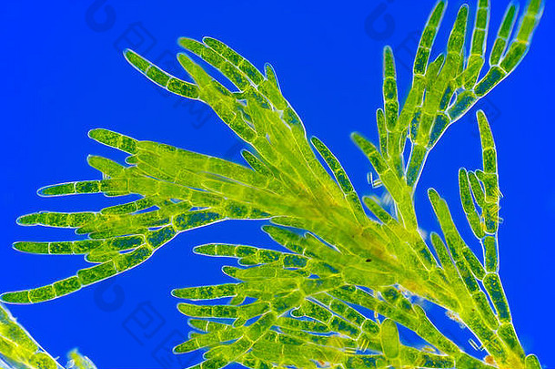 绿藻（枝藻）的显微照片。莱因伯格照明。