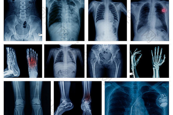 高质量集合x射线图像显示身体部分人类