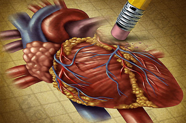失去人类心健康下降血循环导致问题心血管系统铅笔橡皮擦擦除难看的东西医疗插图羊皮纸纸