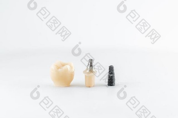 宏拍摄牙科植入物螺杆皇冠白色背景概念假肢植入牙科
