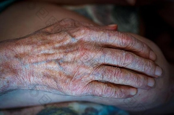 人类皮肤的老化过程——一位90-100岁的老人手上有皱纹，皮肤干燥，布满皱纹和斑点