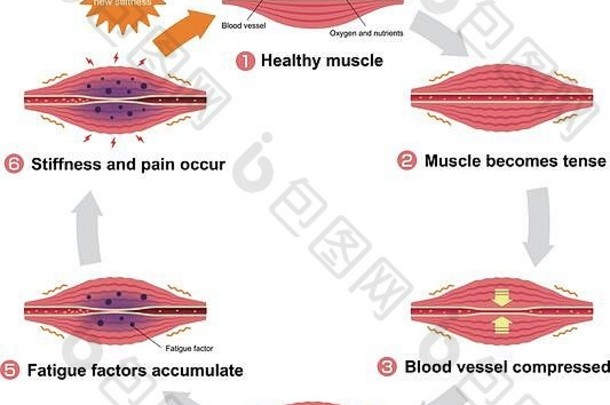 肌肉僵硬和疼痛的过程/圆形插图