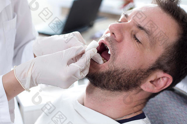 一张白人张着嘴坐在牙科椅上的脸。医生戴着白<strong>手套</strong>的手改变了病人口腔中的木质素辊。