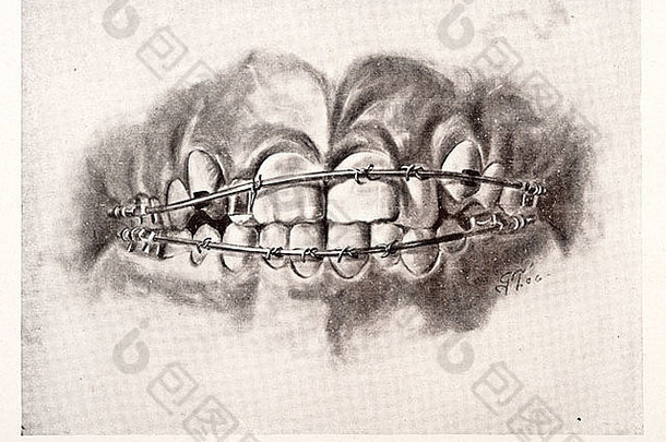 人类牙齿插图版权1911