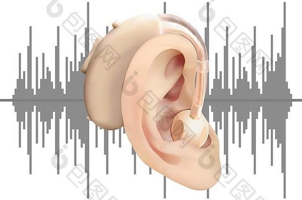 数字听力援助耳朵背景声音波图治疗假肢听力损失耳鼻咽喉科现实的