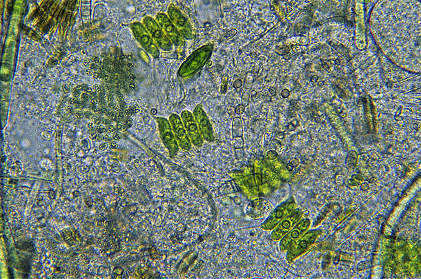 栅藻绿藻门藻类海藻视micrsocopy