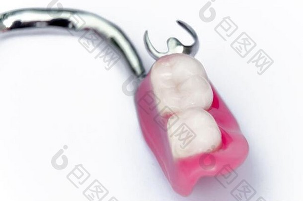 矫形牙科的概念。牙科<strong>修复</strong>术。可拆卸下颌假体。固定钳。出身背景