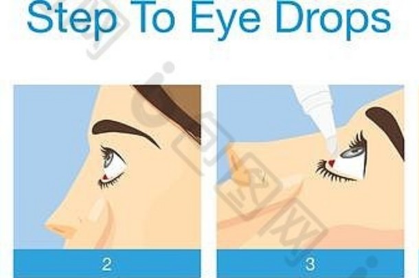 使用滴眼液进行眼部治疗的步骤