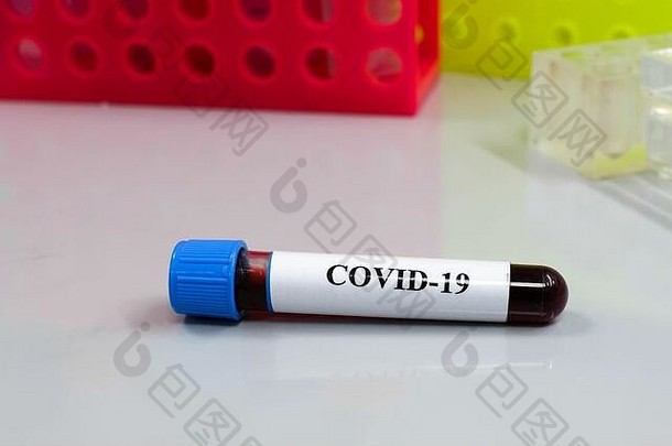 血测试科维德检查血样本存在萨尔斯科夫冠状病毒