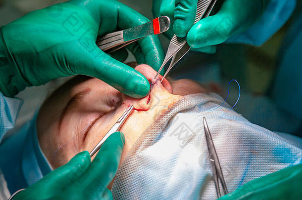 外科医生助理执行化妆品手术鼻子医院操作房间鼻子重塑增加鼻整形术