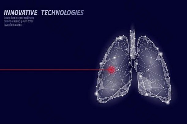 人肺激光手术低聚手术。药物疾病药物治疗疼痛区。红色三角形多边形3D渲染形状。药房