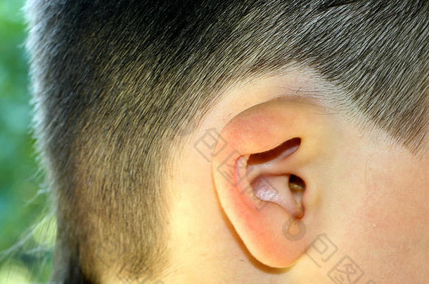 畸形的耳朵。耳廓发育不正常。整形美容