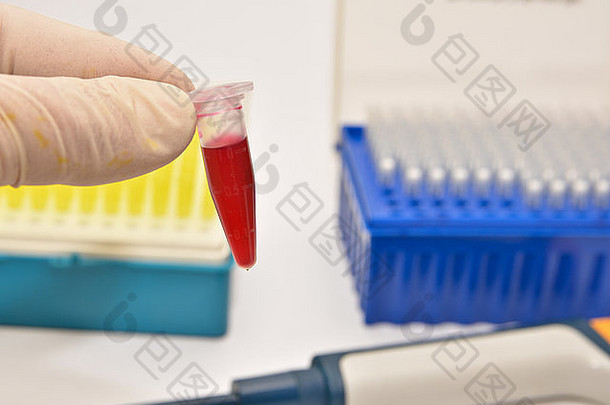 这管血。在医学实验室中对人类血液的研究。