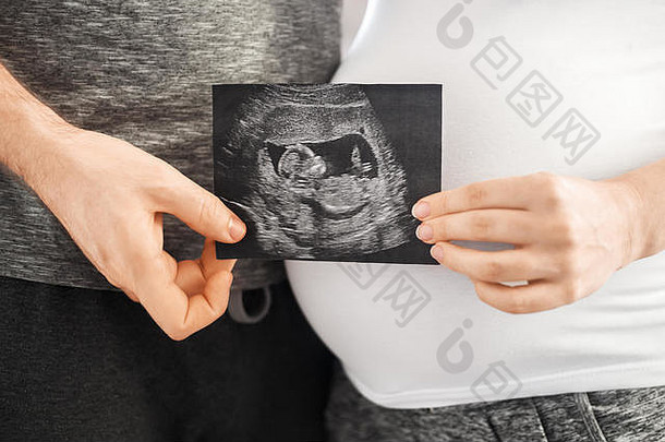 怀孕夫妇进行超声波扫描