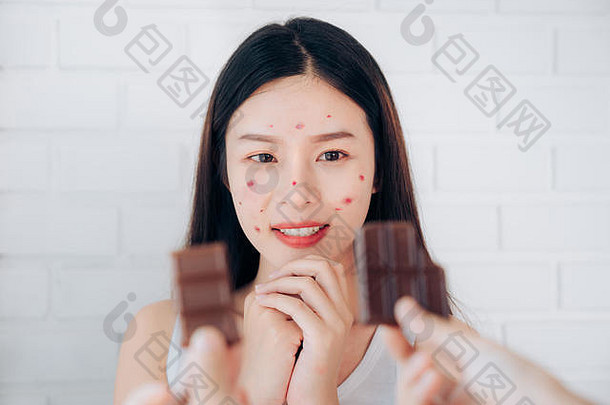 年轻的亚洲女人痤疮问题脸巧克力酒吧快乐吃