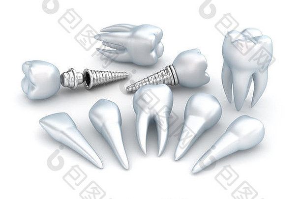 牙齿植入物牙科概念白色