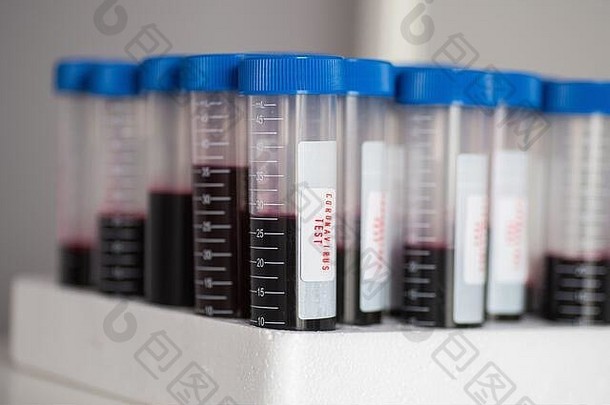 测试管血冠状病毒测试