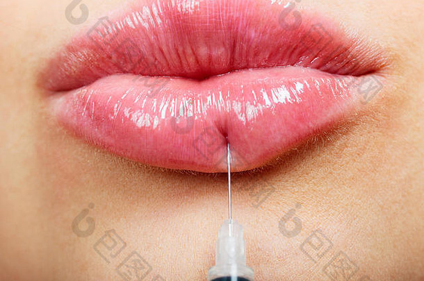 特写镜头拍摄美丽的女嘴唇注射器填料