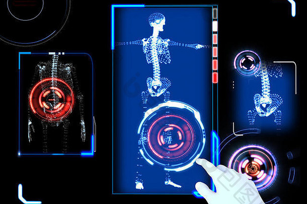 医疗设备，医院，体检，解剖扫描，未来医学，3d骨骼。医务室。交互式屏幕。