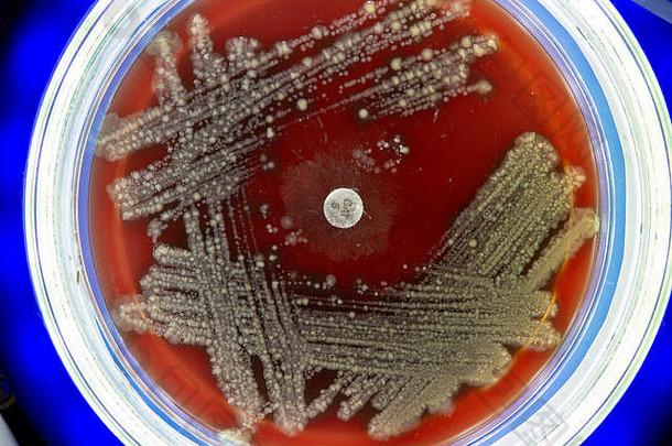 有微生物菌落的皮氏培养皿