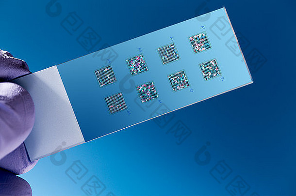 DNA微阵列，DNA芯片或生物芯片，附着在玻璃表面的纳米DNA点阵列，用于测量大量DNA的水平