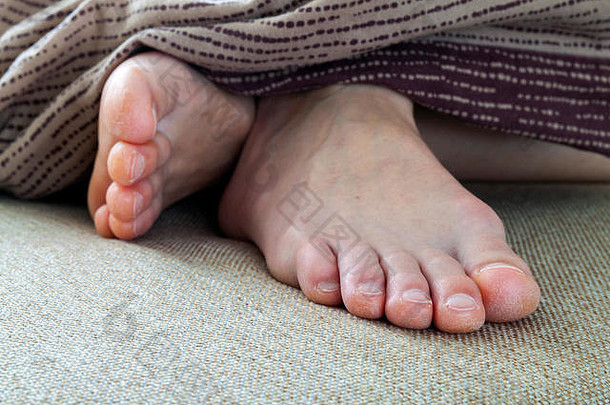 在床上的女人脚干裂的皮肤。足部治疗。