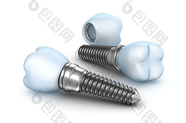牙科植入物，牙冠，白色隔离针
