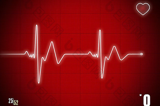 心电图显示死亡时刻。