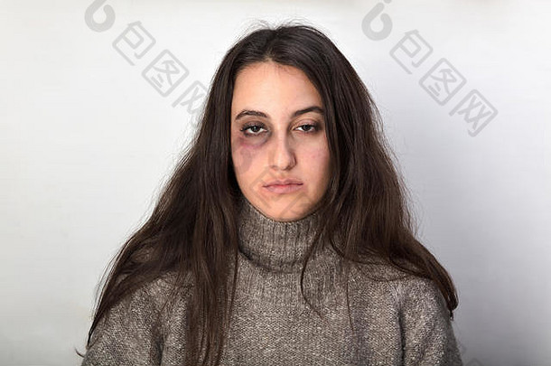 一名被虐待、眼睛青肿的妇女——家庭暴力的受害者——在白色摄影棚背景下摆姿势，盯着摄像机