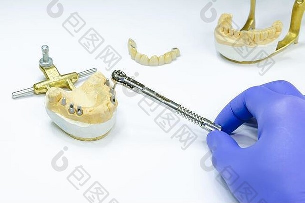 牙医用钥匙拧开植入物。植入修复术。种植体上牙冠的生产。牙种植