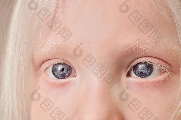 白化病儿童眼睛的特写照片，小女孩有着不同寻常的眼睛、头发、眉毛和睫毛颜色。自然美、白化病概念