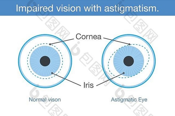 视力正常和视力受损，前视有散光。
