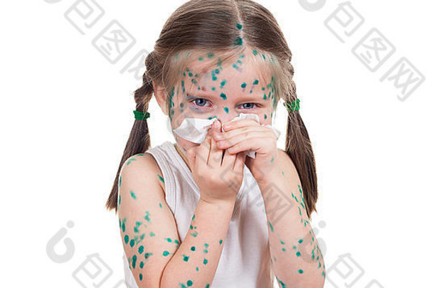 acnes孩子水痘