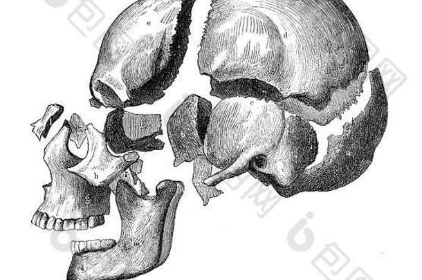 经典解剖学插图，带颌骨和牙齿的头骨，骨骼视图