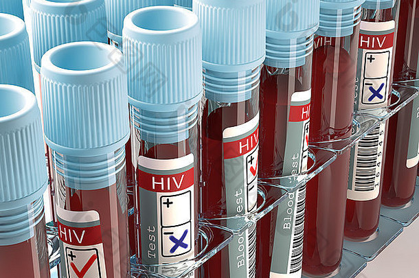 图像概念与HIV检测结果一致。