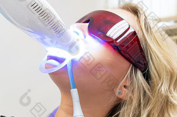youn gblonde女士坐在牙科手术椅上用光敏聚合物美白牙齿的特写照片