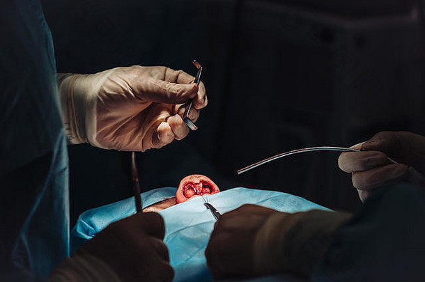 化妆品手术鼻子外科医生削减肉