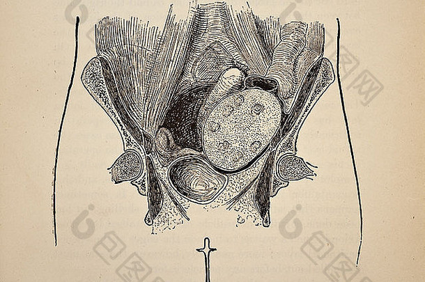 Harrison Cripps的卵巢切除术和腹部手术版权所有1898
