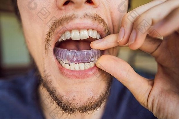 男人。放置咬板口保护牙齿晚上磨引起的夜间磨牙症关闭视图手设备