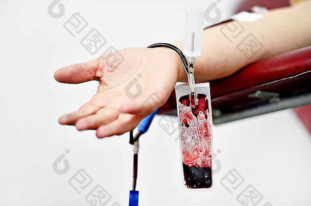 一名献血者的手和一个医院的塑料血袋的细节