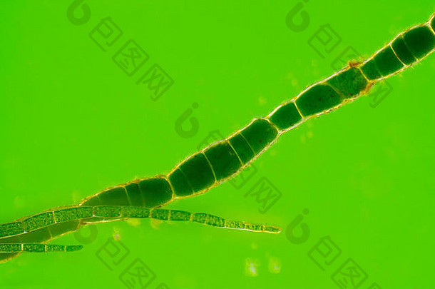 绿藻（枝藻）细丝的显微视图。莱因伯格照明。