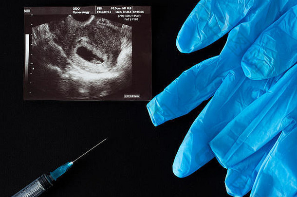 流产，妊娠测试结果，医用手套和注射器，黑色背景