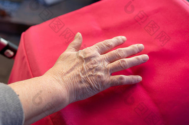 这是一位手指疼痛的老妇人的手