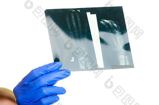 女人医生手持有手臂x射线图像孤立的医疗人健康保险